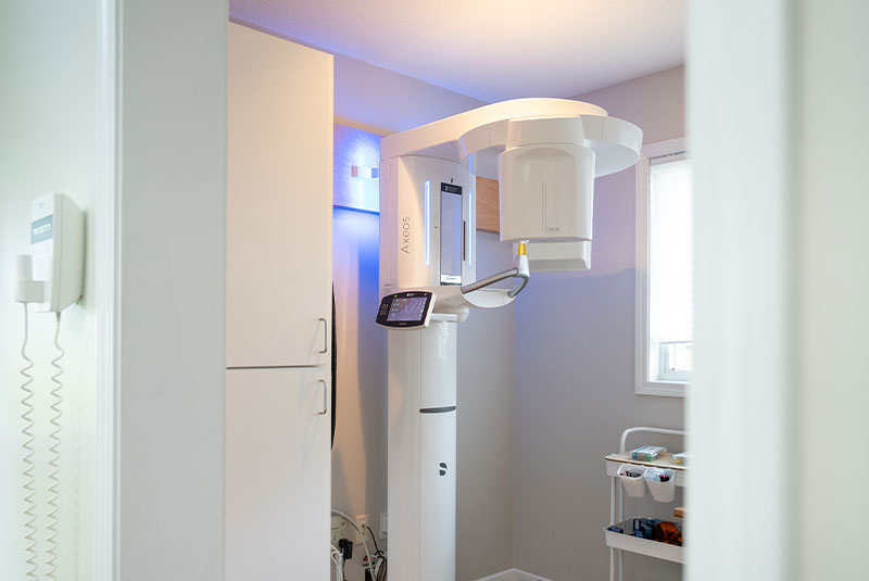 cbct pulled out