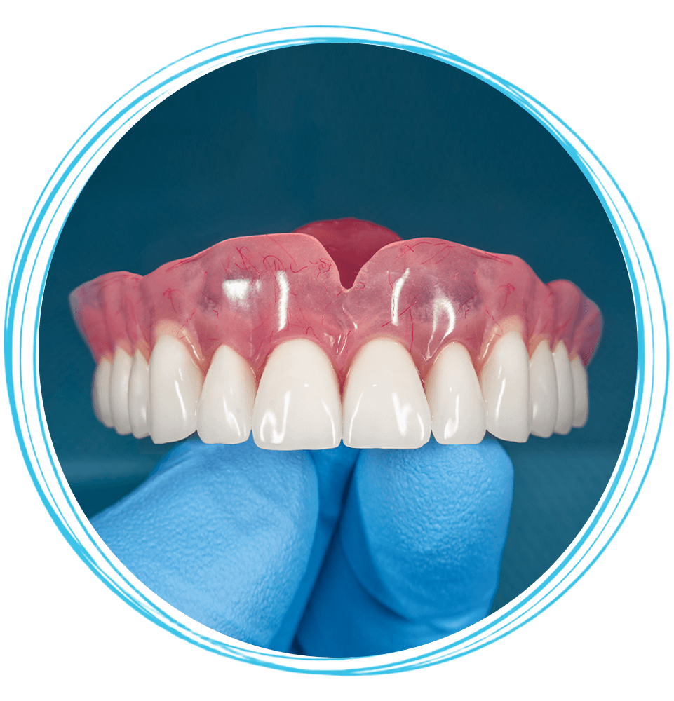 immediate dentures