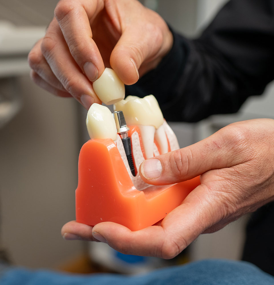 implant model real