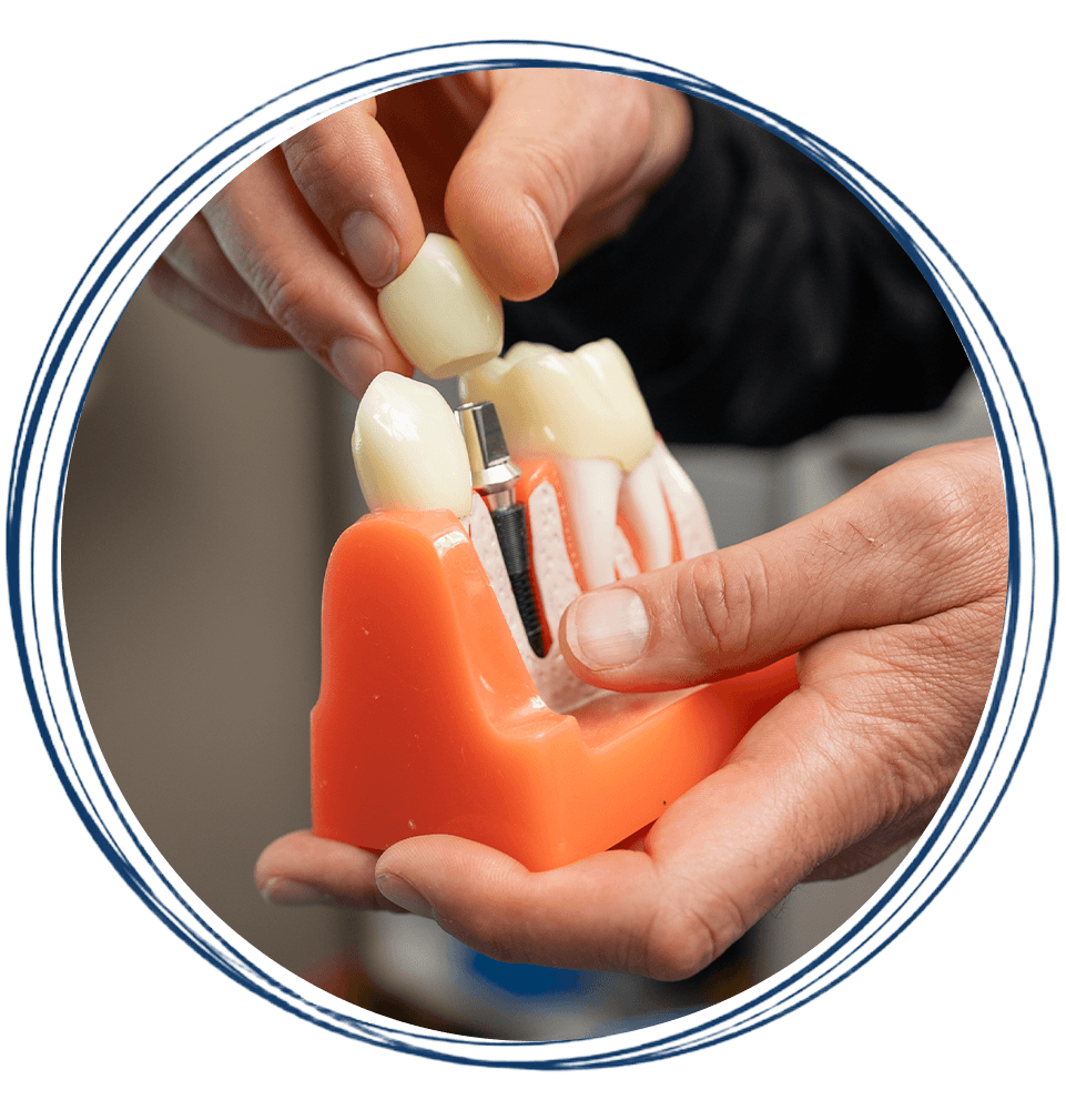 close up of implant