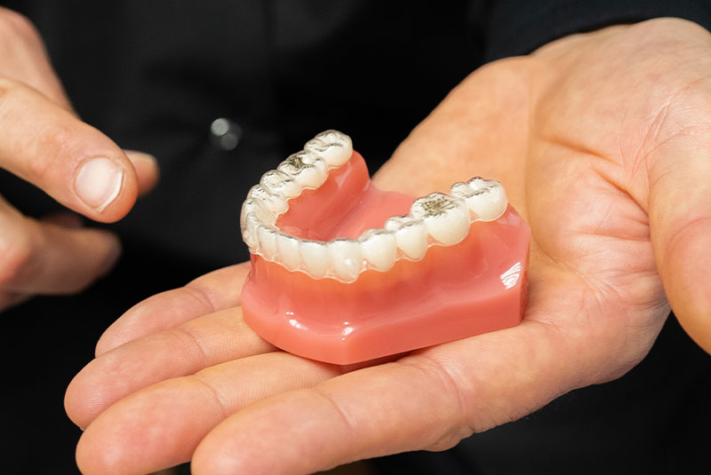 invisalign model