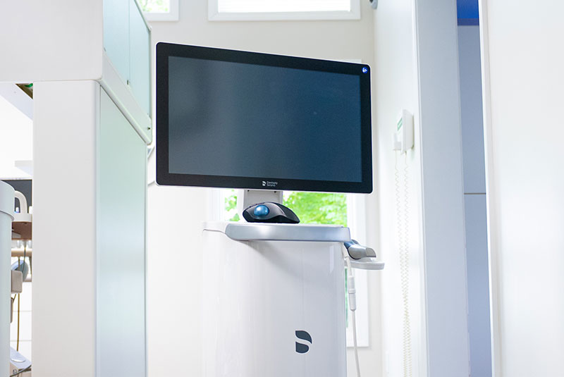 itero machine
