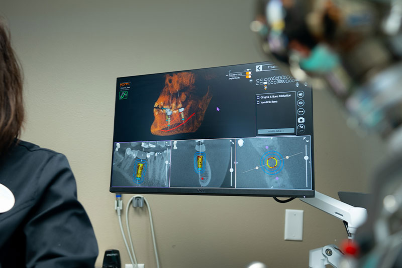 digital xray